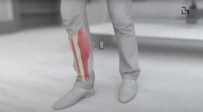 Algoritmi e magneti insieme per gli arti protesici del futuro | Osservatorio C Quadra